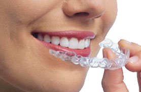 Invisalign